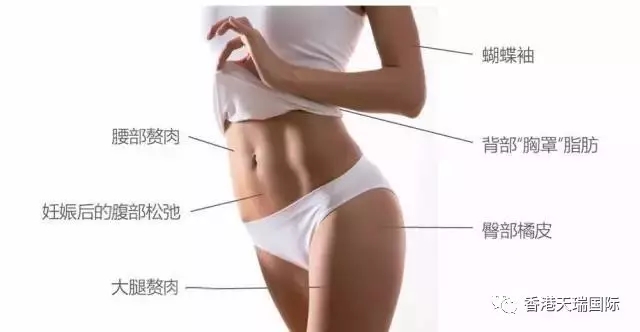 現(xiàn)下流行的BTL脂肪刀，有什么效果？