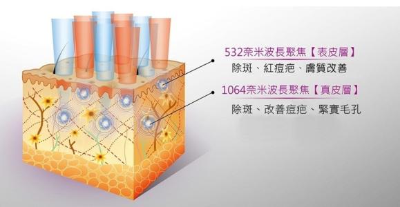 祛痘我用點(diǎn)陣，你呢？！