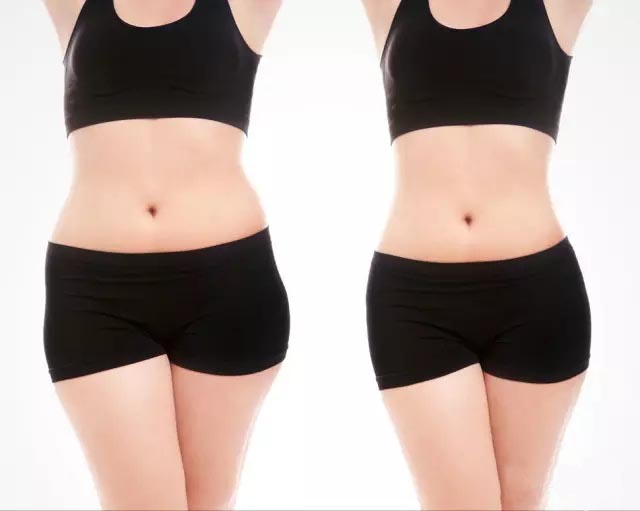 UltraShape優(yōu)立塑非侵入式專利科技、有效、安全！